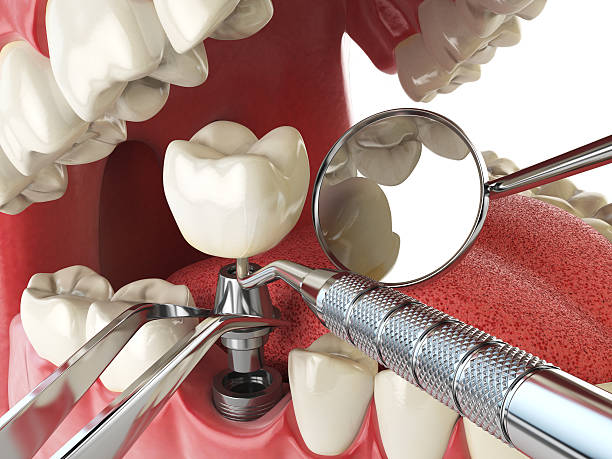 Best Knocked-Out Tooth Emergency  in Dudley, NC